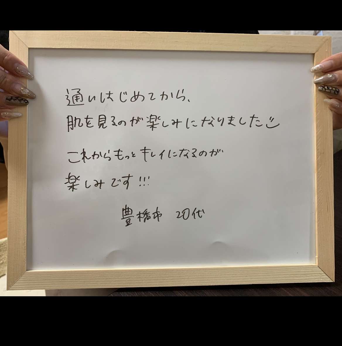 お客様の声!20代女性